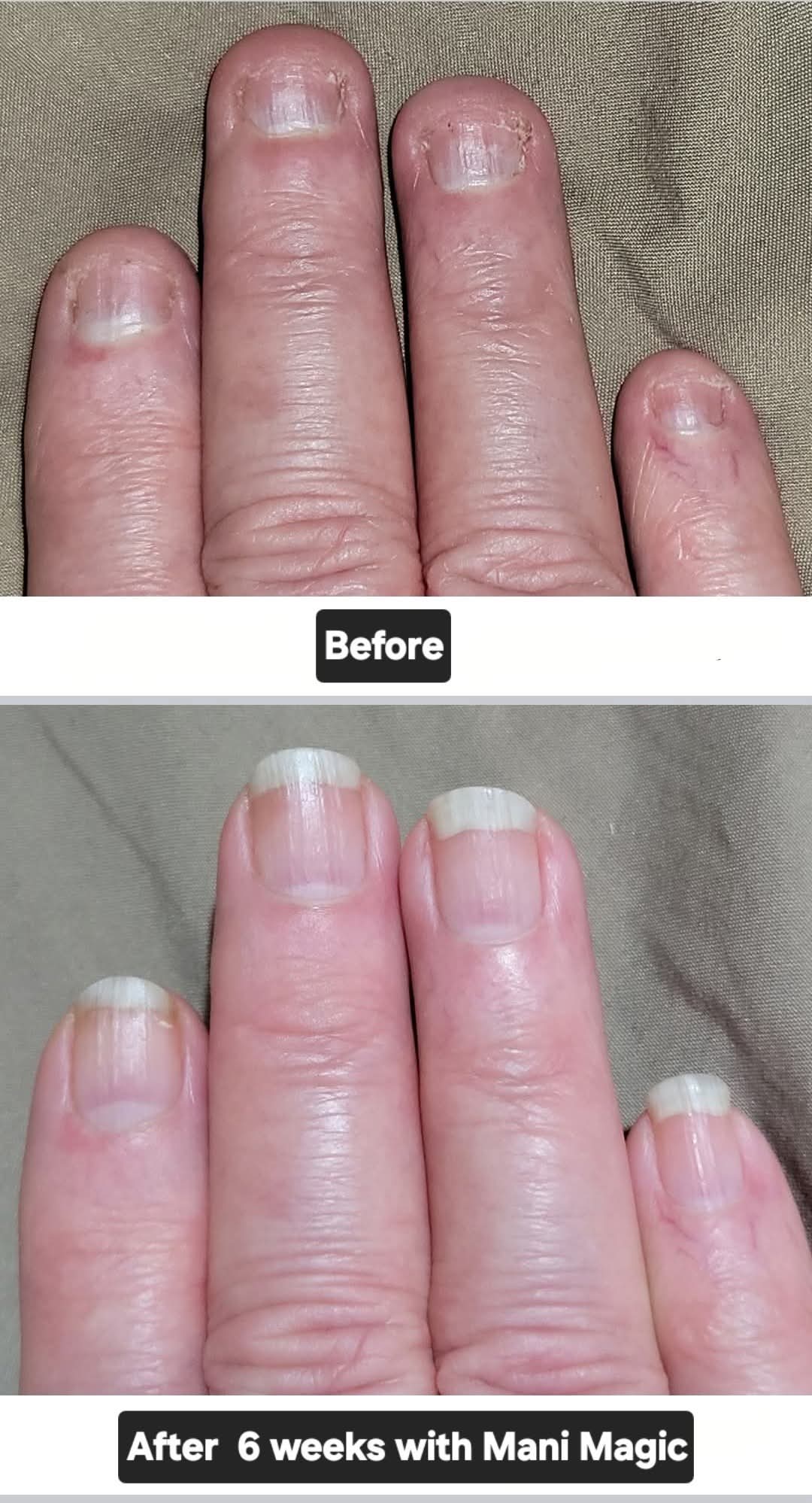 A Before and After